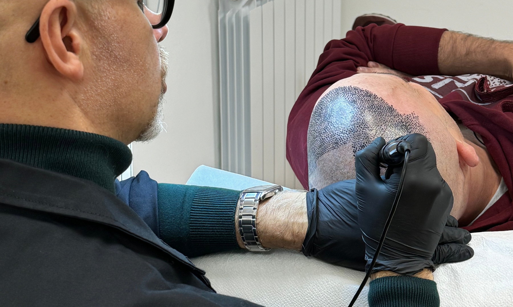 Tricopigmentazione: quanto costa e quanto dura?