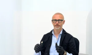 Tempi di recupero dopo la tricopigmentazione cosa aspettarsi