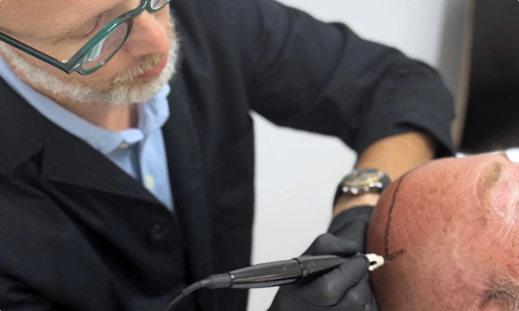 Tricopigmentazione senza segreti 10 falsi miti da sfatare