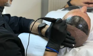 Pigmenti per tricopigmentazione certificazioni, sicurezza e qualità
