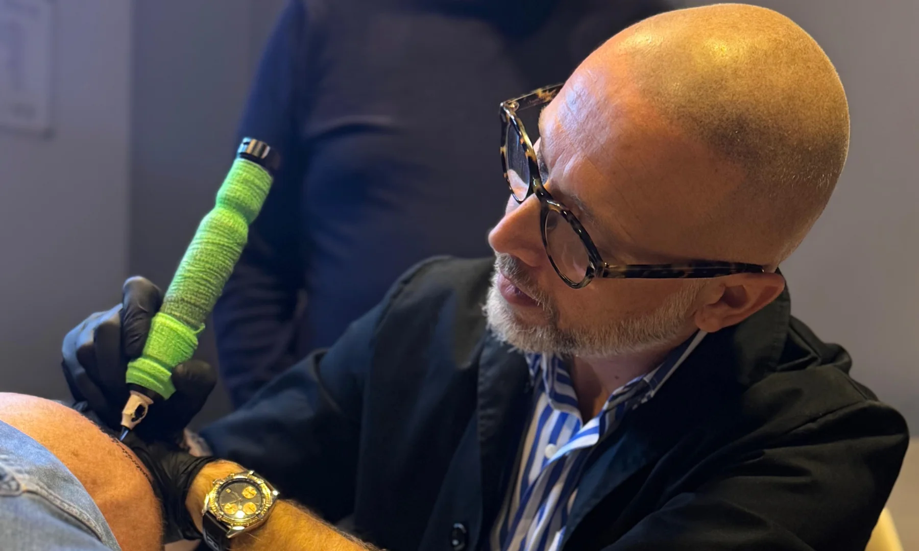 Applicazioni e soluzioni della tricopigmentazione trova il trattamento perfetto per te